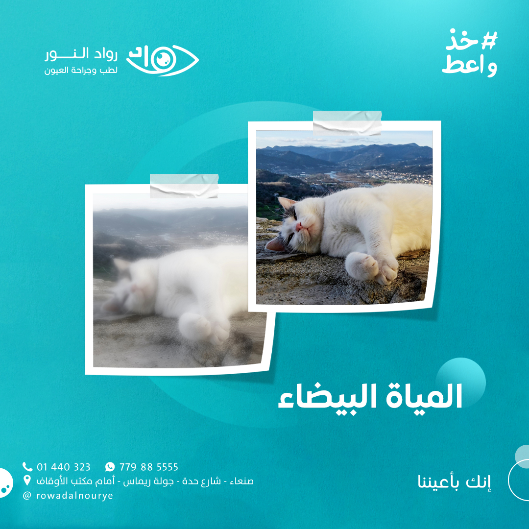 الشباك المغبر